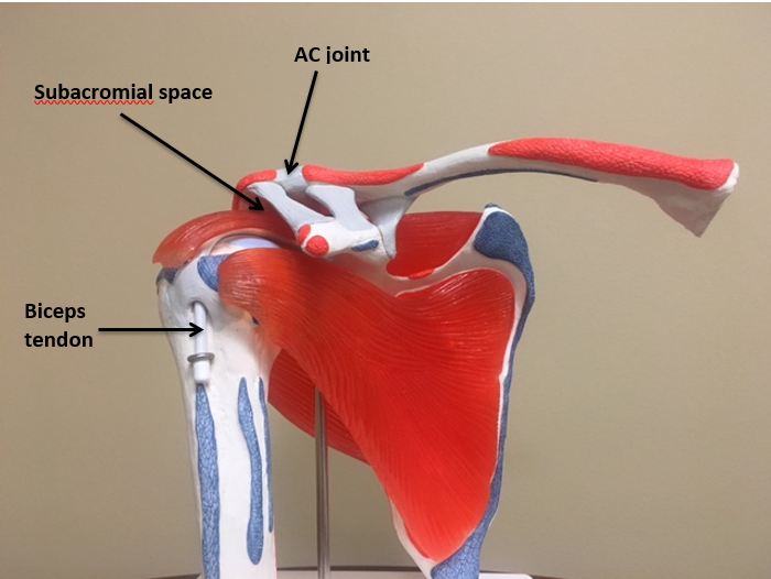 2016-04APR08_TRO_Rotator Cuff Tear 2